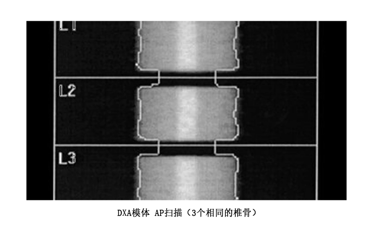 德國QRM DXA脊柱骨密度測量模體